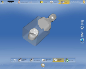CEREC Software Schematic of a Crown's Milling Process at Cocoa Village Dentistry